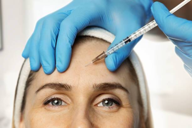 Wrinkle Reduction